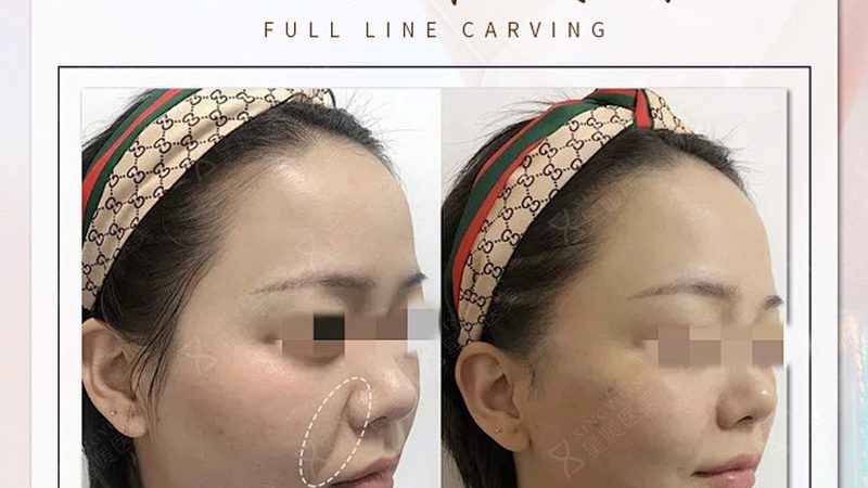 抗衰之旅：揭秘常见抗衰方法背后的陷阱