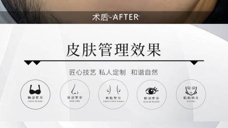小标题：超声炮术后饮食建议