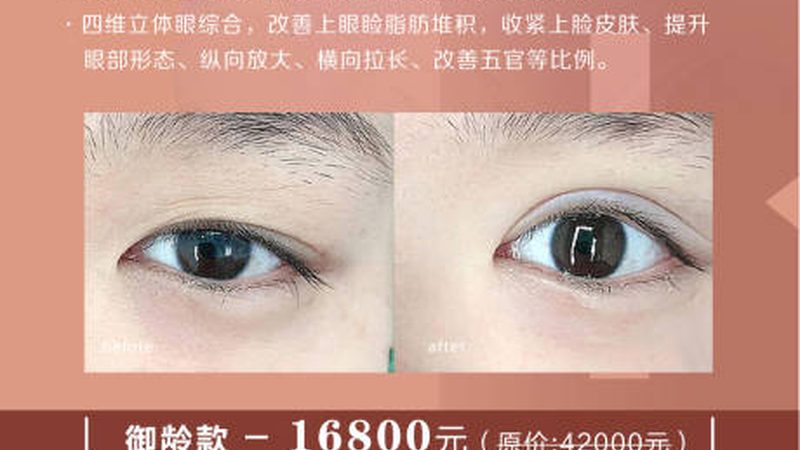 光子嫩肤与热玛吉：揭秘抗衰利器背后的技术差异