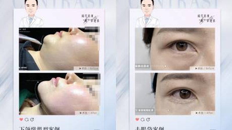 打完玻尿酸别急着美，恢复期做对这几件事才不白花钱