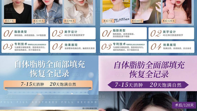 激光脱毛禁忌人群有哪些？揭秘那些不宜尝试激光脱毛的人群