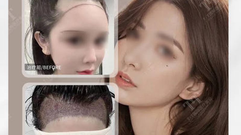 以下是对轻医美行业十大品牌的简要盘点，供投资者参考：