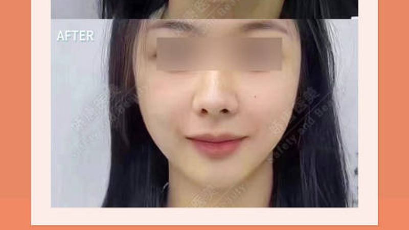 揭秘皮肤管理家用仪器：品牌排名背后的真相