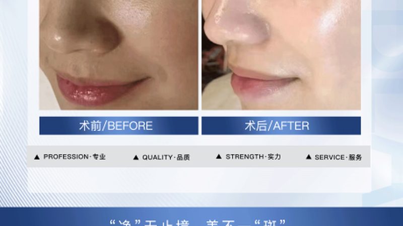 瘦脸按摩，你真的做对了吗？**
