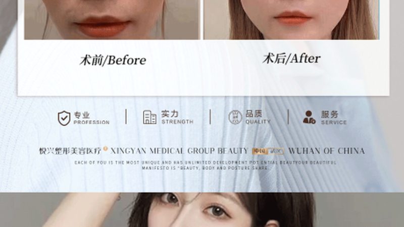 孕妇打水光针，风险与注意事项揭秘