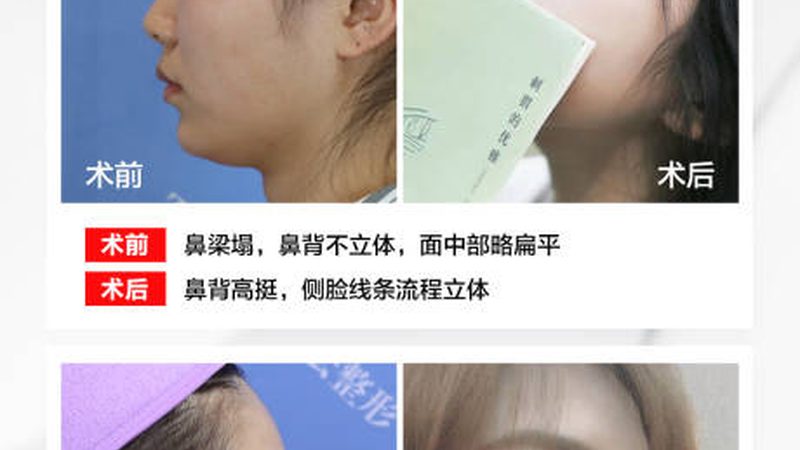成都皮肤管理加盟，如何规避这些常见误区？**