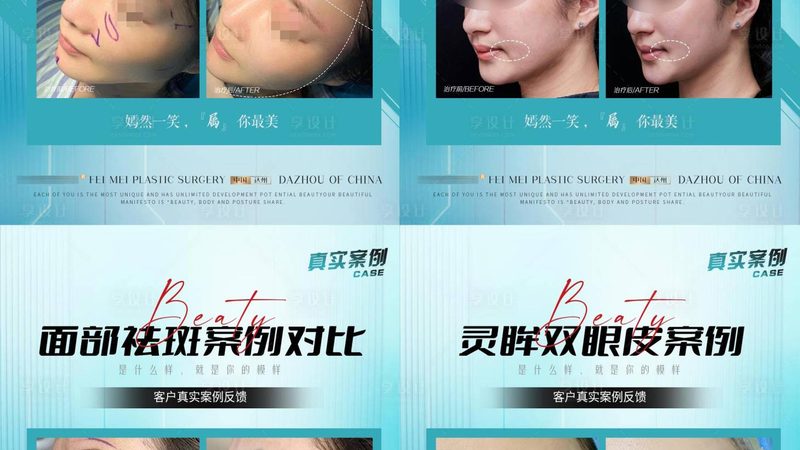 上海医美医院如何挑选？揭秘五大关键要素