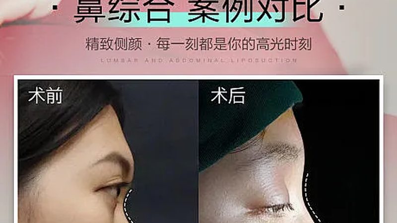 上海抗衰诊所服务项目分类解析