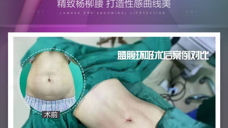 光子嫩肤后反黑现象，了解真相才能安心变美