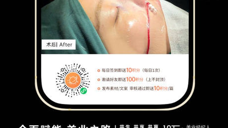 抬头纹肉毒素副作用