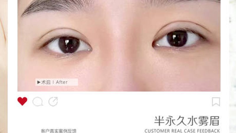 抗衰激光超声刀，定制方案如何打造？**