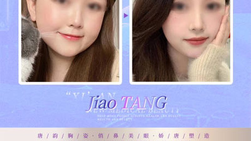 脸部瑜伽，轻松打造精致小脸