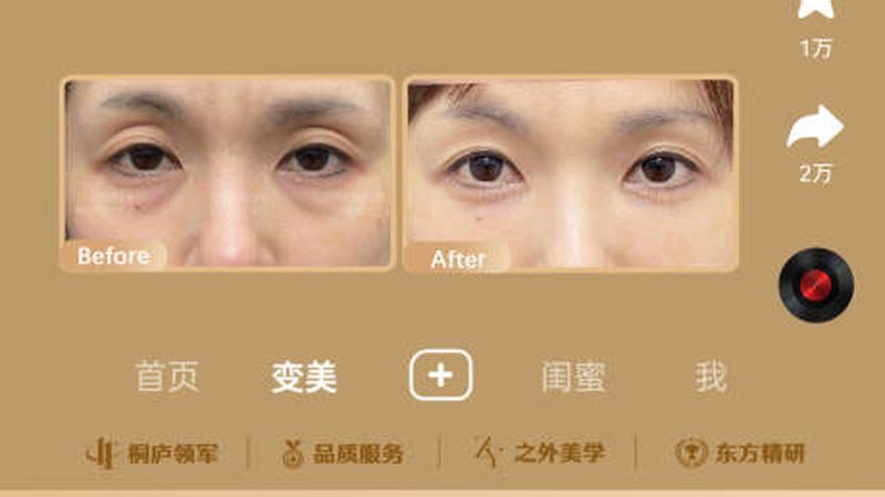 北京下颌角截骨哪家医院好
