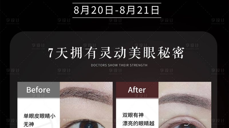 双眼皮贴松弛？揭秘双眼皮成型与修复之道