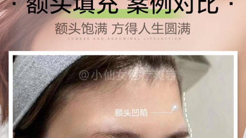 小标题：术后红肿原因解析